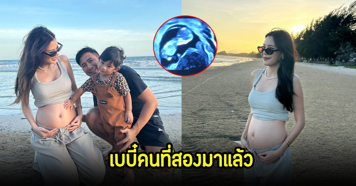 นางร้ายสุดแซ่บ ประกาศข่าวดีลูกคนที่2มาแล้ว เหล่าดาราร่วมยินดีเพียบ