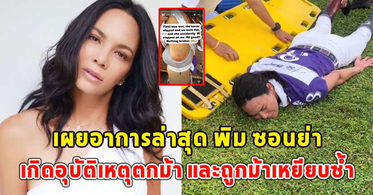 เผยอาการล่าสุด พิม ซอนย่า เกิดอุบัติเหตุตกม้า และถูกม้าเหยียบซ้ำ