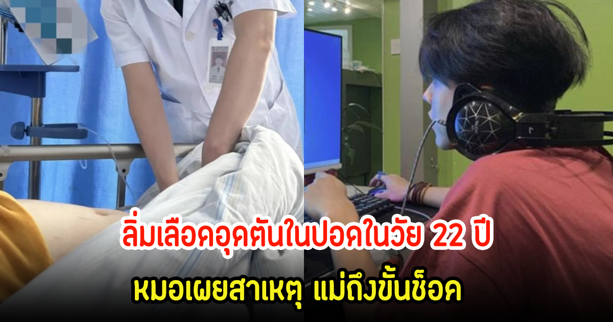 หนุ่มวัย 22 ปี ป่วยลิ่มเลือดอุดตันในปอด แม้ไม่สูบบุหรี่ ไม่ดื่มแอลกอฮอล์ หมอเผยสาเหตุ แม่ถึงขั้นช็อค