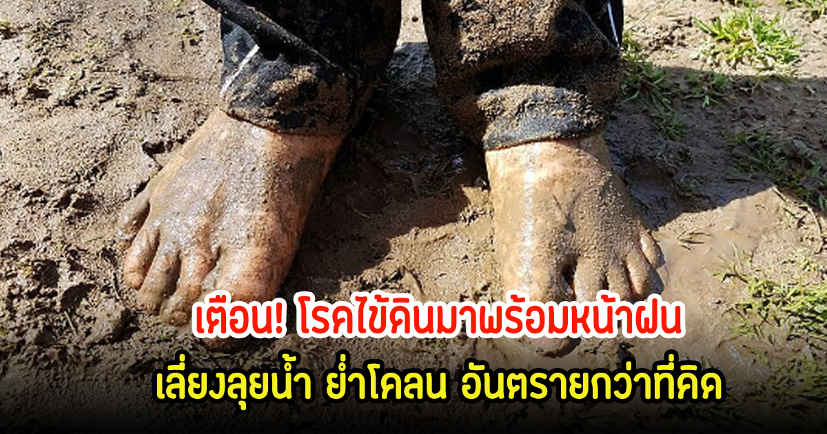 เตือน! โรคไข้ดินมาพร้อมหน้าฝน เลี่ยงลุยน้ำ ย่ำโคลน อันตรายกว่าที่คิด