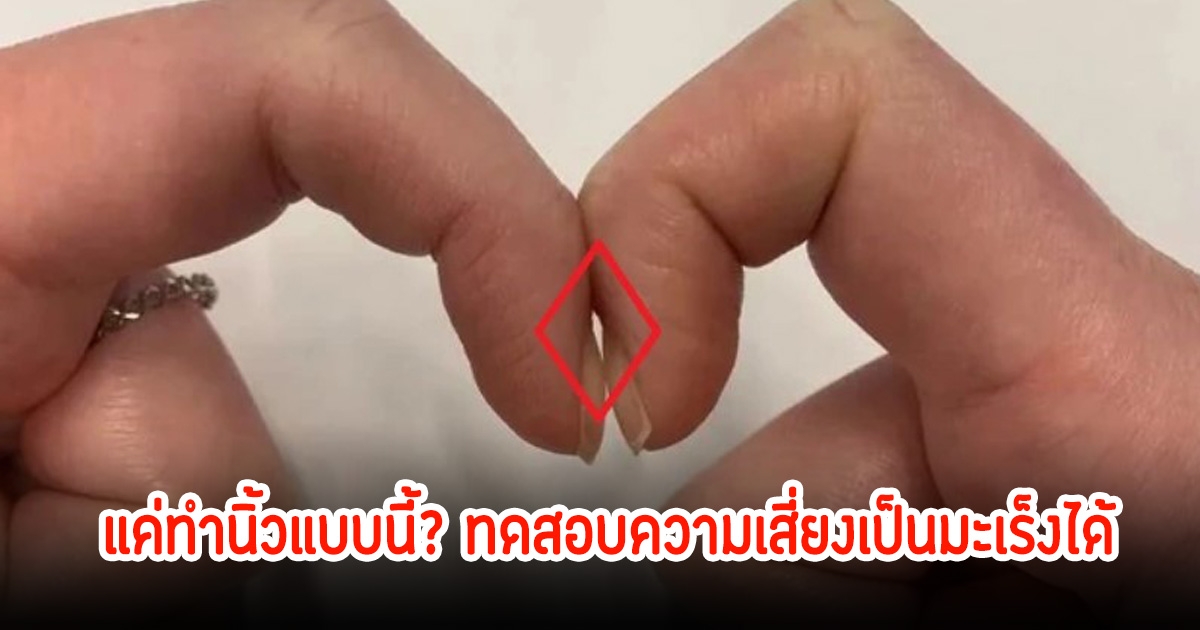 ผู้เชี่ยวชาญออกมาแนะเอง แค่ทำนิ้วแบบนี้? ทดสอบความเสี่ยงเป็นมะเร็งได้