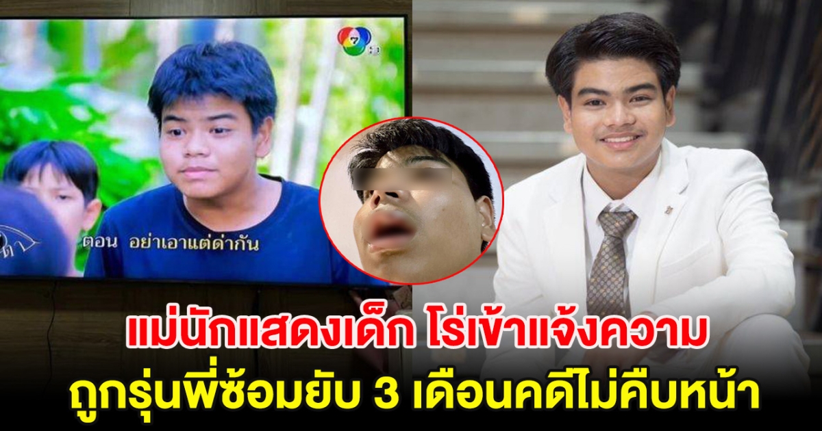 แม่นักแสดงเด็ก โร่เข้าแจ้งความ ถูกรุ่นพี่ซ้อมยับ 3 เดือนคดีไม่คืบหน้า