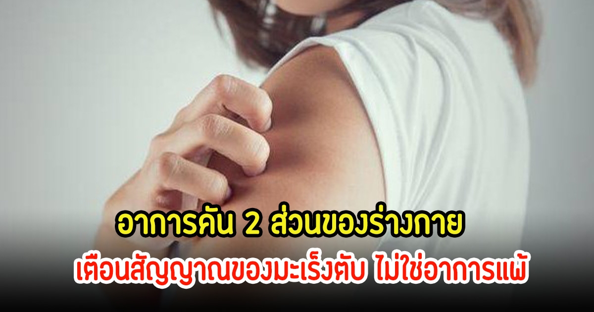 อย่าชะล่าใจ! อาการคัน 2 ส่วนของร่างกาย เตือนสัญญาณของมะเร็งตับ ไม่ใช่อาการแพ้