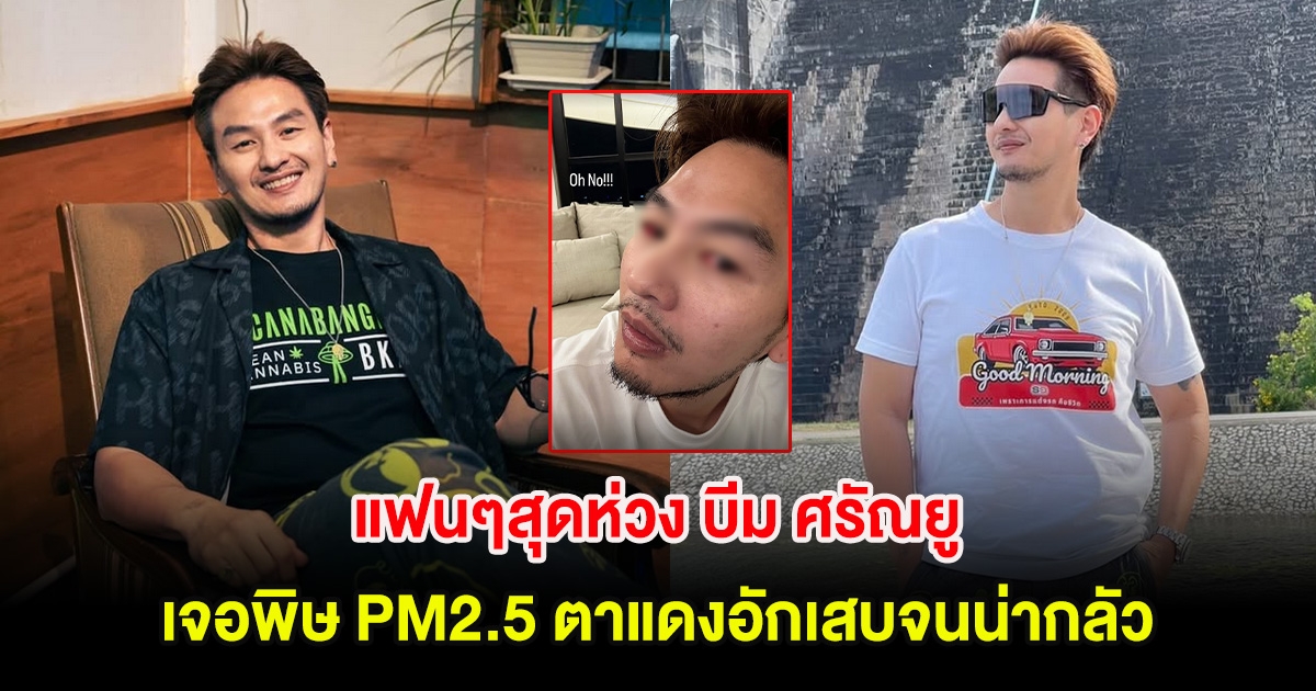 แฟนๆสุดห่วง บีม ศรัณยู เจอพิษ PM2.5 ตาแดงอักเสบจนน่ากลัว