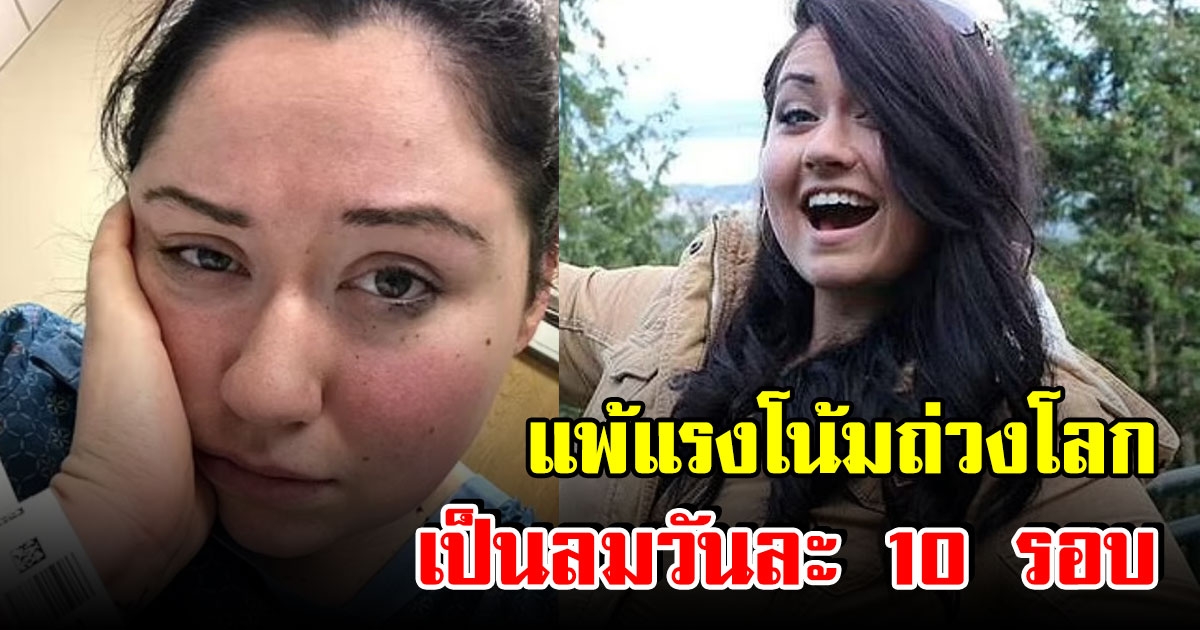 สาวสุดแปลก แพ้แรงโน้มถ่วงโลก เป็นลมวันละ 10 รอบ ยืนได้นานแค่ 3 นาที