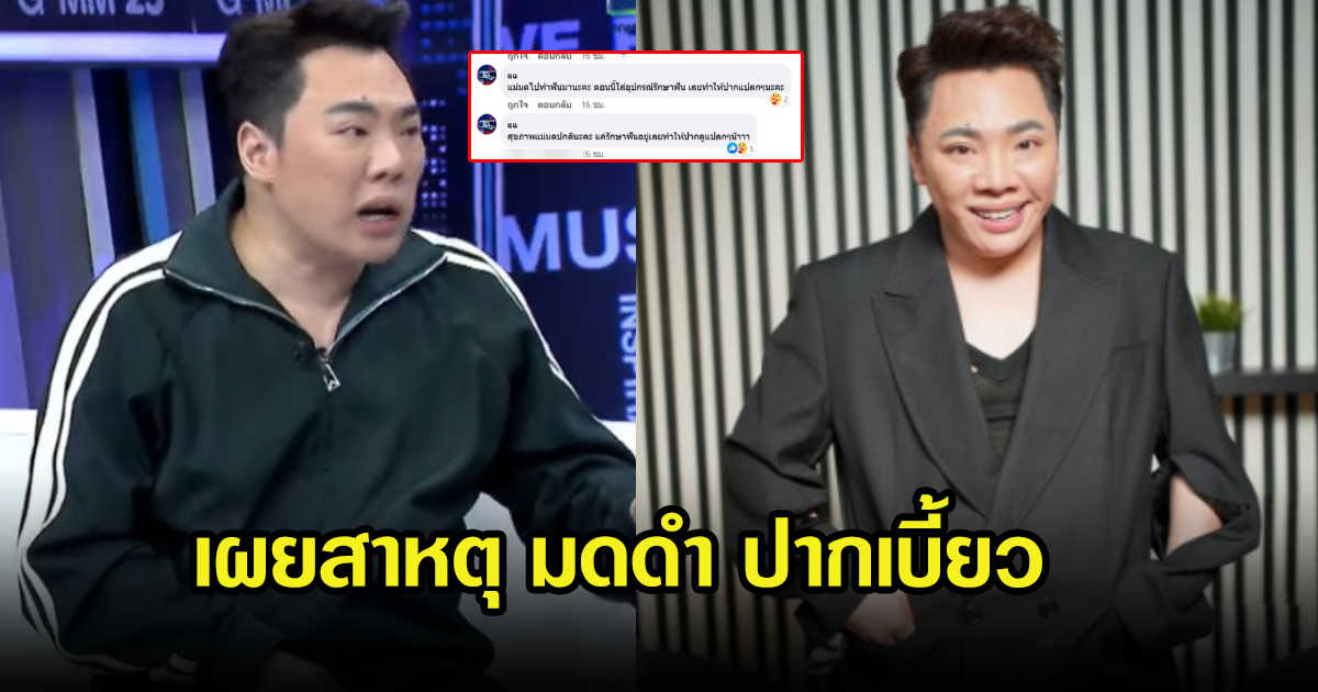 เผยสาเหตุ มดดำ คชาภา หลังชาวเน็ตเป็นห่วง เห็นปากเบี้ยว ตอนจัดรายการ