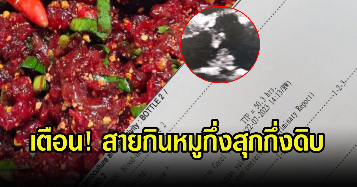 สายกินหมูกึ่งสุกกึ่งดิบระวัง ติดเชื้อหูดับลุกลามสมอง เผยใช้ตะเกียบคีบหมูสดเสี่ยงเช่นกัน