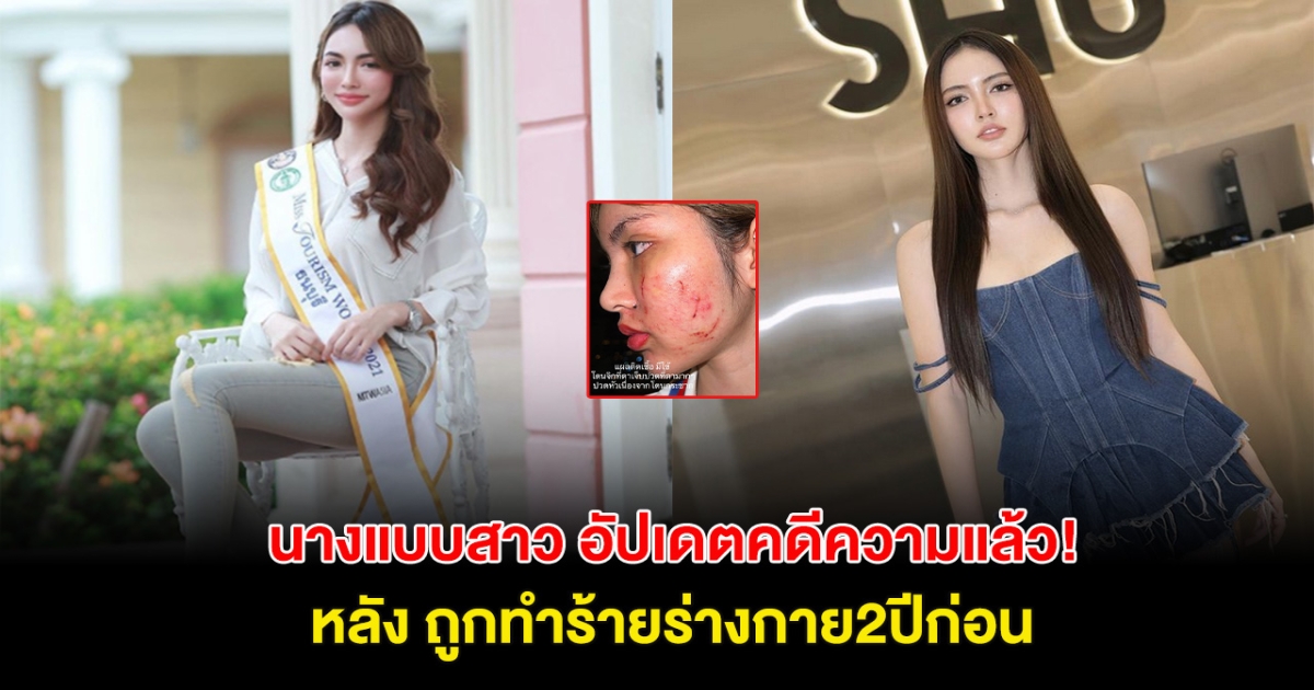 ชนะคดีเเล้ว! นางแบบสาว แจ้งข่าวดี หลัง ถูกทำร้ายร่างกาย2ปีก่อน